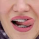narrow palate